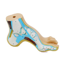 Model van een holle voet Model van een holle voet
