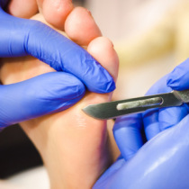 Pourquoi choisir des lames en acier au carbone pour ses études en podologie ? Pourquoi choisir des lames en acier au carbone pour ses études en podologie ?