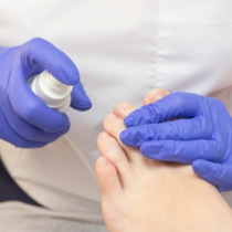 Quels désinfectants choisir en fonction des plaies présentes sur les pieds d’un patient ? Quels désinfectants choisir en fonction des plaies présentes sur les pieds d’un patient ?