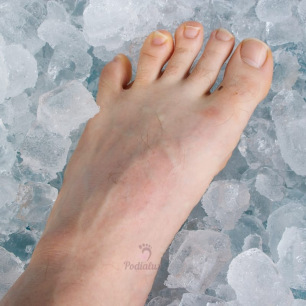 Foot under chemotherapy