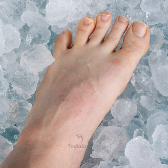 Foot under chemotherapy