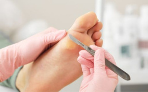 Wat is een gutsbeitel en wanneer gebruik je deze?