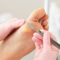 What is a gouge blade and in what cases should it be used? What is a gouge blade and in what cases should it be used?