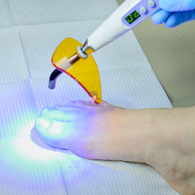 Polymerisatielamp VRN V300