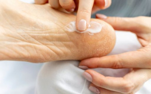 Les avantages des soins des marques Akileïne® et Gehwol