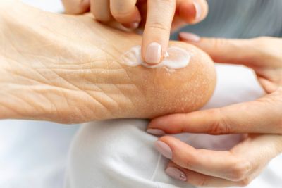Podologue utilisant des soins pour pieds des marques Akileïne® et Gehwol.